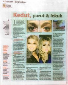 Read more about the article Kedut, Parut & Lekuk