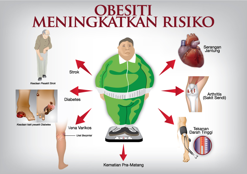 Read more about the article Cara Rawatan Obesiti